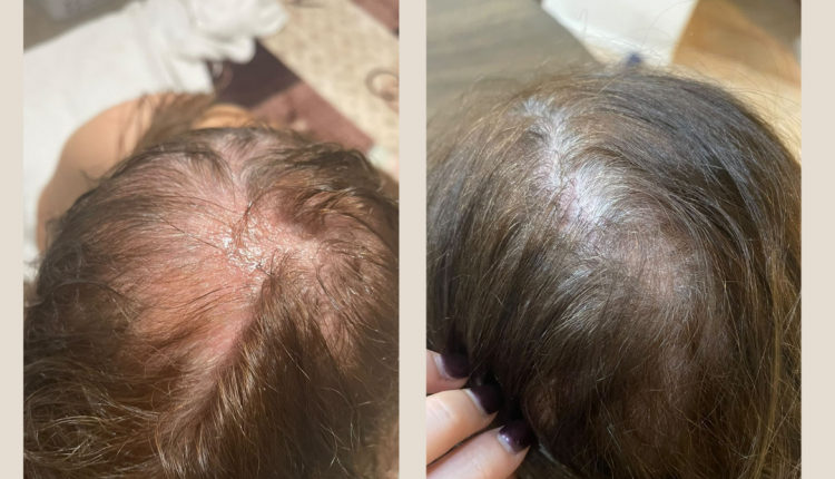 1 Customer before and after Instagram Post