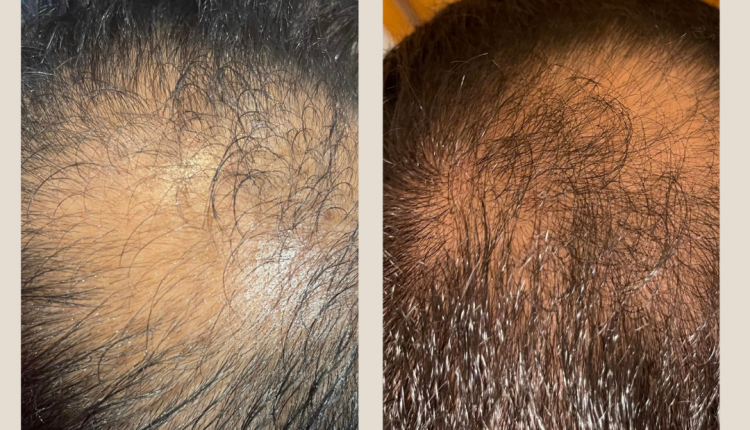 10 Customer before and after Instagram Post (1)