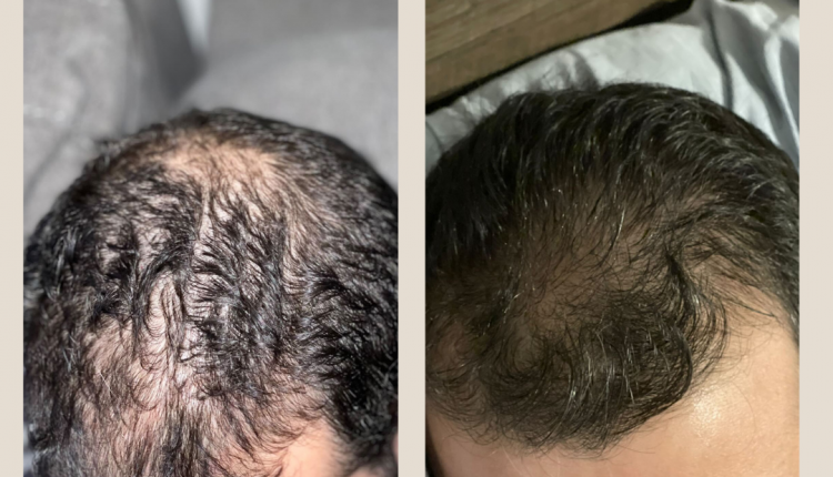 11 Customer before and after Instagram Post (1)
