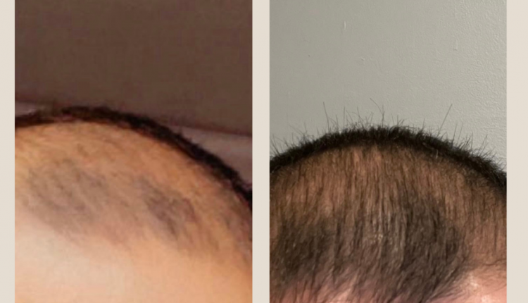 12 Customer before and after Instagram Post