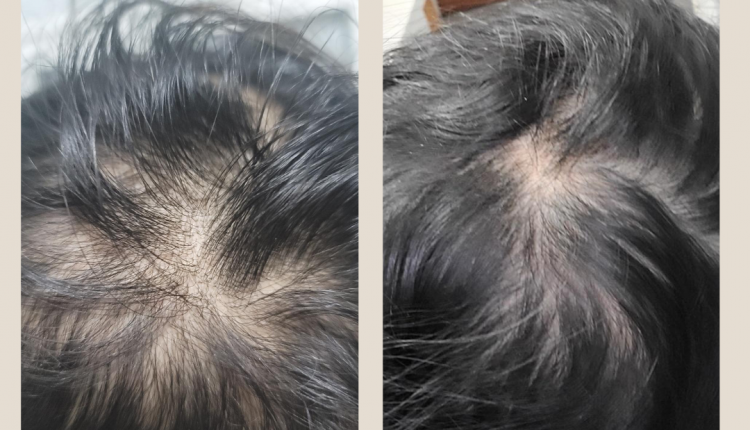 13 Customer before and after Instagram Post