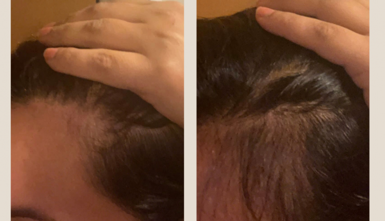 2 Customer before and after Instagram Post (1)