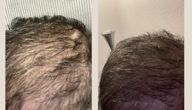 3 Customer before and after Instagram Post (1)