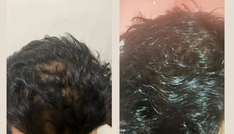 4 Customer before and after Instagram Post