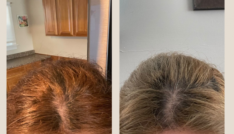 6 Customer before and after Instagram Post